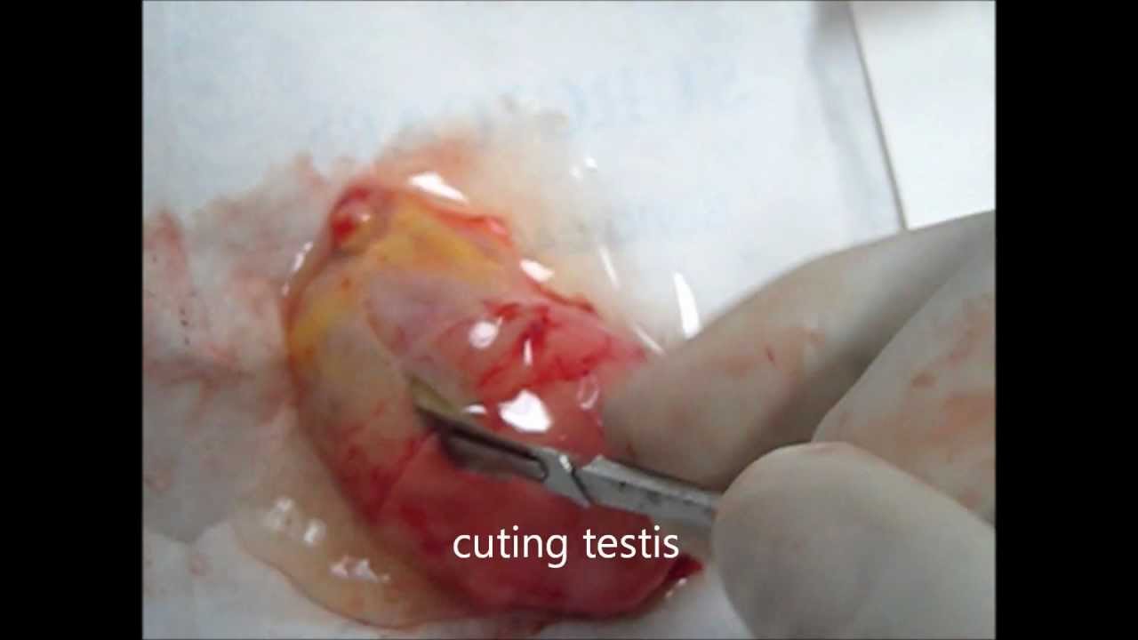 Testicle Removal Pictures 105