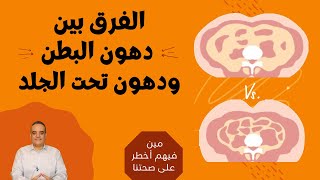 الفرق بين دهون البطن والدهون تحت الجلد - وايهما أكثر خطورة على الصحة