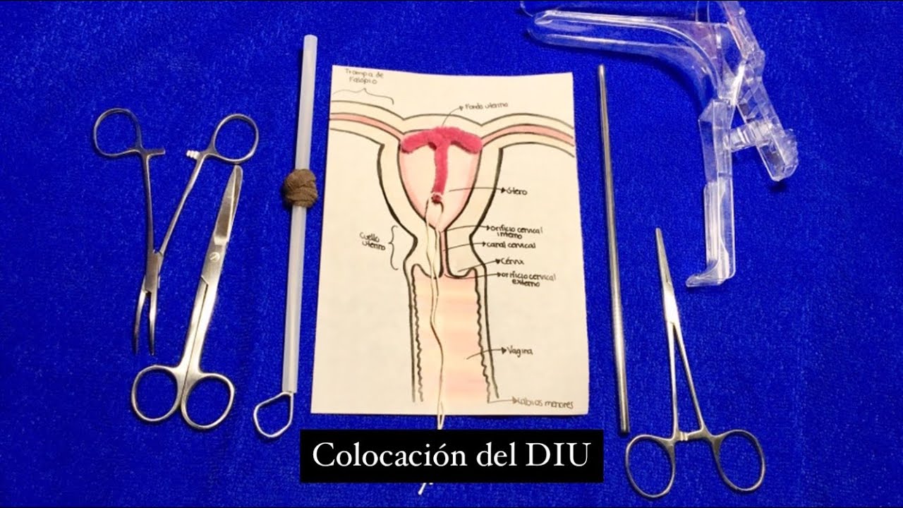 Cómo Colocar El Diu , Guía práctica para la colocación segura y ...