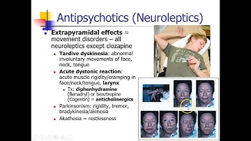 OLD VIDEO - ANES 476 - Week 4 - Part 2