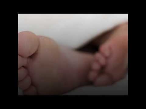 Vidéo: Comment traiter un orteil écrasé : 14 étapes (avec photos)