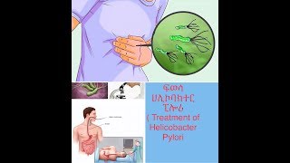 ፍወሳ ሀሊኮባክተር ፒሎሪን ክንክተሎ ዝግብኣና ኣመጋግባን ( Treatment of Helicobacter Pylori and diet to follow)