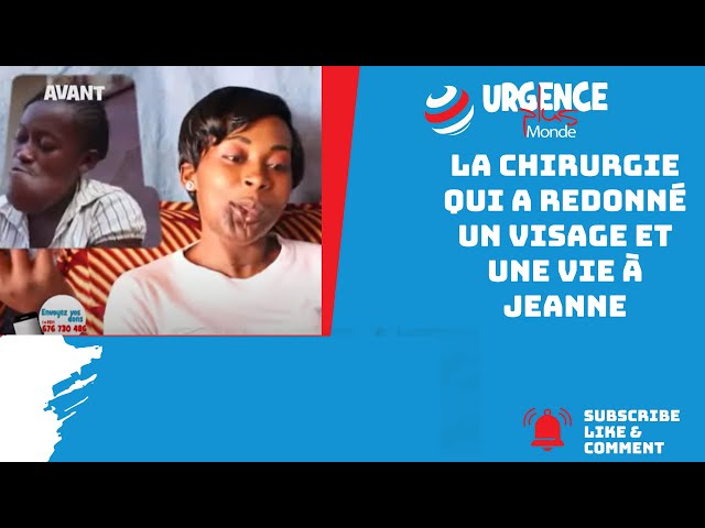 La chirurgie qui a redonné un visage et une vie à Jeanne