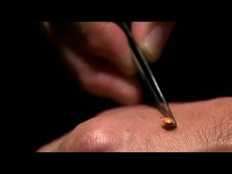 Come rimuovere un segno di spunta