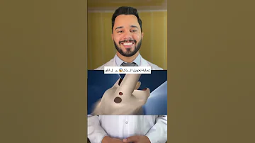 عملية تحويل الرجل لامرأة 