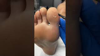 Experience Relief With This Aussie Podiatrist's Foot Healing Magic! #Footcare #Wellnessdownunder