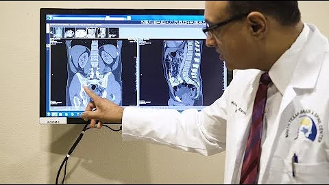 Low Back Pain and the Sacroiliac Joint - Dr. Alexa...
