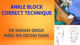 ANKLE BLOCK. DETAILED TECHNIQUE. DR HAKAM SINGH