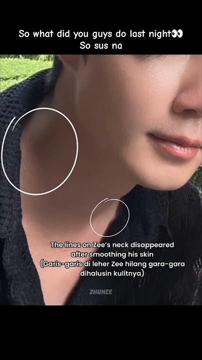 so sus na👀did you get bitten by a nhu mosquito?🤪 #zeenunew #zeepruk #nunew #blshorts