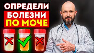 Ваши почки – НЕ В ПОРЯДКЕ! / О чем говорит ЦВЕТ МОЧИ?