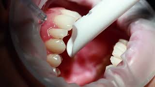 The Ascent Dental Care Orthodontic Journey