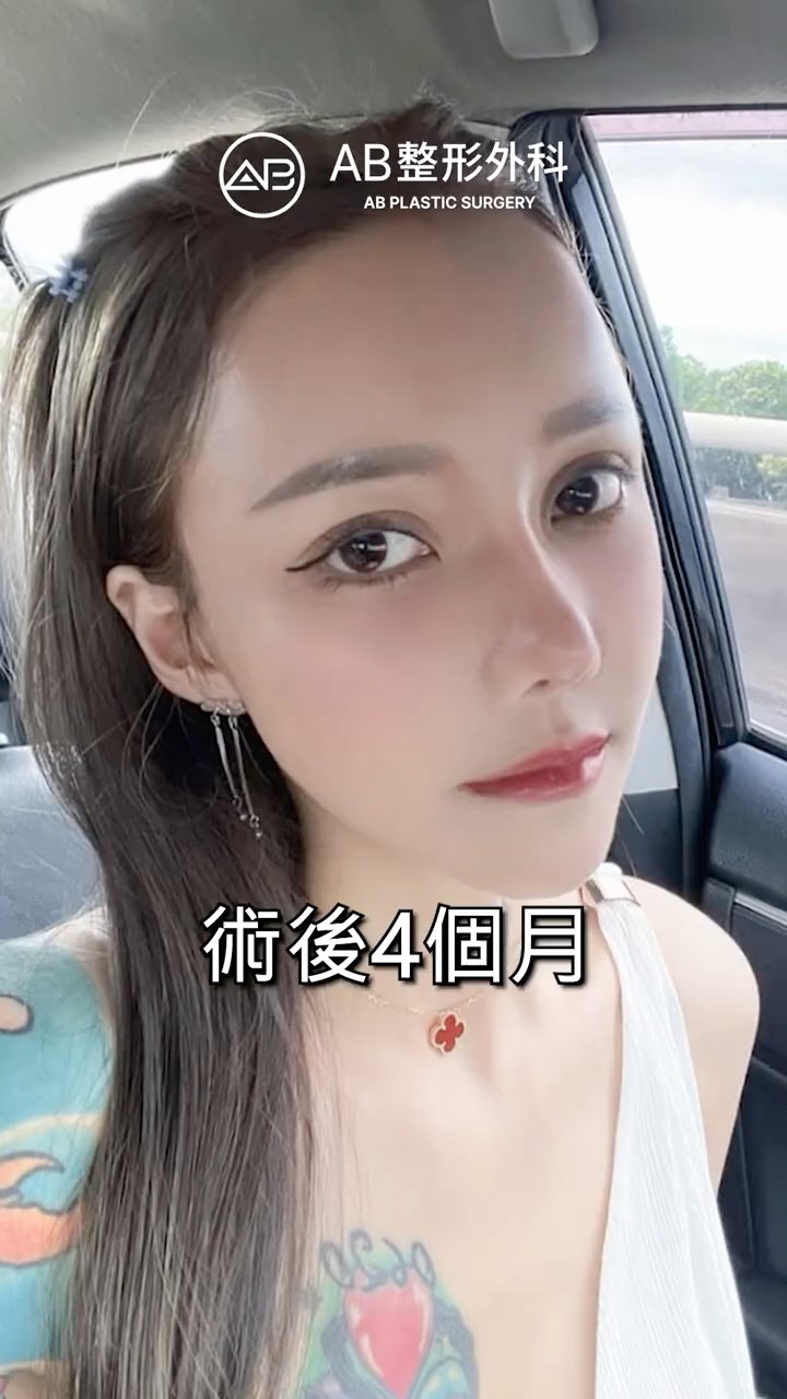 鼻整形 全臉面部拉皮術打造凍齡女神✨ #Shorts