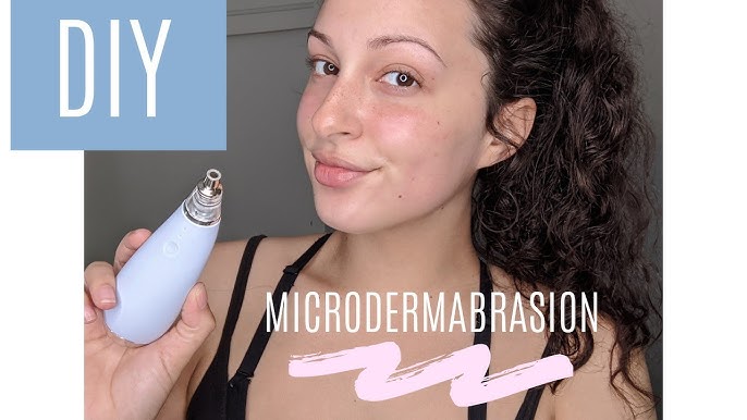 Hip or Hype? Trophy Skin MicrodermMD Review - Cheap and Cheeky