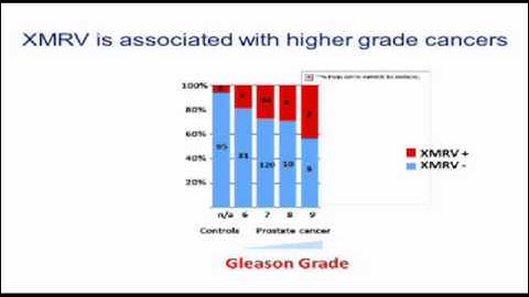 "XMRV and Human Diseases: Prostate Cancer and CFS" Pt. 2