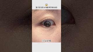 헐..지금 당장 눈 밑을 확인해보세요...😳