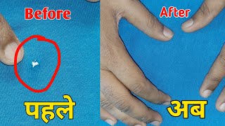 How to Repair Holes in Clothes Without Stitching