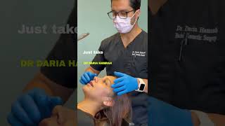 How to do nasal massage  #nosejob #newnose #rhinoplasty