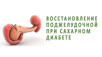 Восстановление поджелудочной железы при сахарном диабете