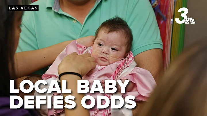 Premature baby defies odds, graduates from NICU at UMC Children's Hospital