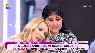 Arzu Boztaş Kollarını Ve Bacaklarını Kocasının Saldırısında Yitirdi