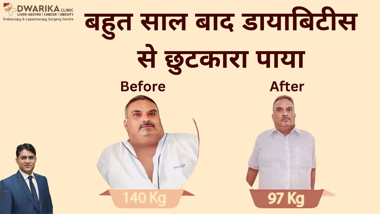 The Revolutionary Snoring & Over-Weight Treatments 