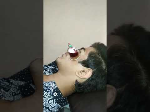 Hijama  for acne vulgaris