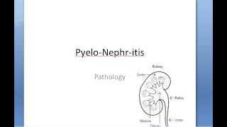 Pathology 676 a PyeloNephritis Acute Chronic Infection Kidney VesicoUreteral Reflux Gross Microscopy