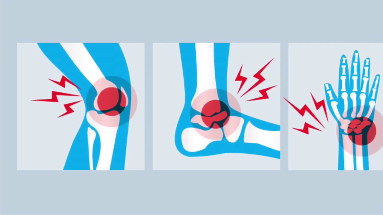 Схематическое изображение травмы. Травма рисунок. Спортивные травмы рисунки. Человечки травма. Повреждение травмы рисунок.
