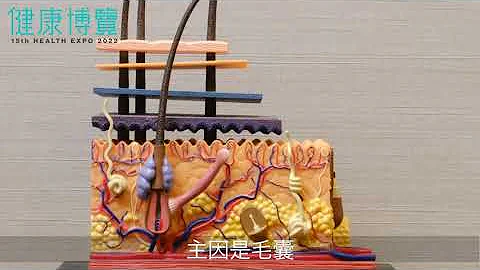 如何處理脫髮問題 - 天天要聞