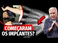 Organização de Santa Catarina prepara microchip para ser implantado no Brasil! - E se for verdade?