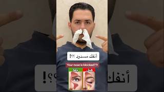 أنفك مسدود ؟