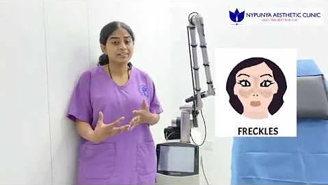 BEST FRECKLE removal treatment in Bangalore | Expert Cosmetic Dermatologist | Nypunya Clinic