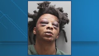 Jacksonville police release report, booking photo of man accusing officers of brutality