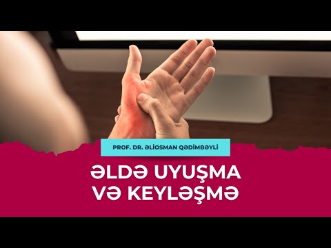 Əl uyuşması - Prof. Dr. Əliosman Qədimbəyli