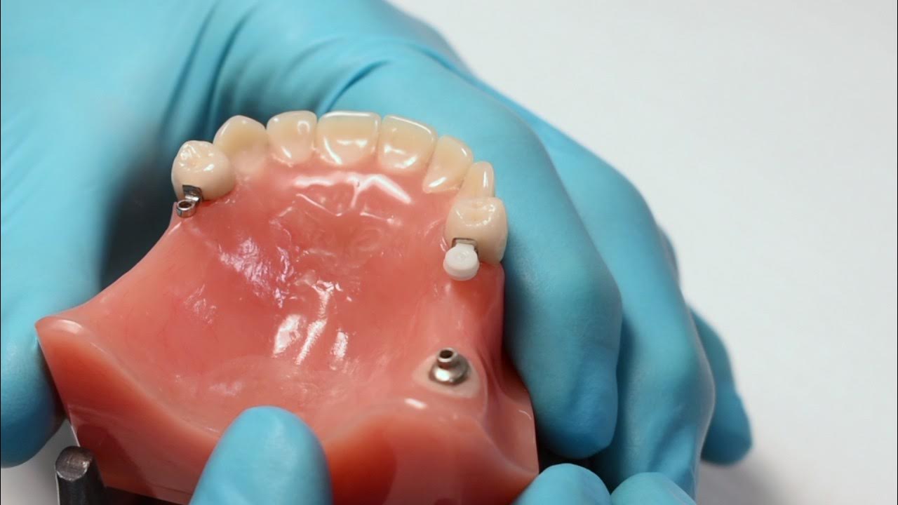 ERA® Male Attachments The Basic Understanding of the Levels of Retention YouTube