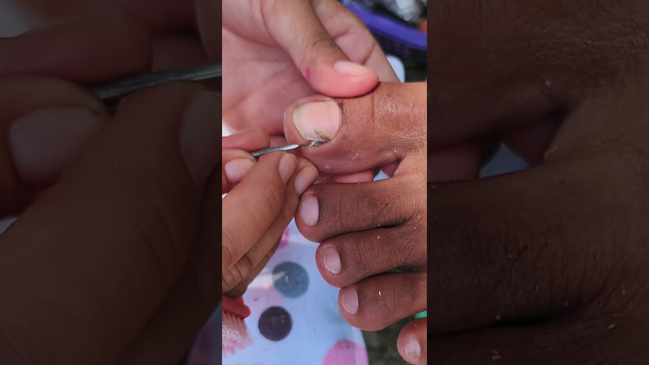  Pedicure Satisfying Shorts