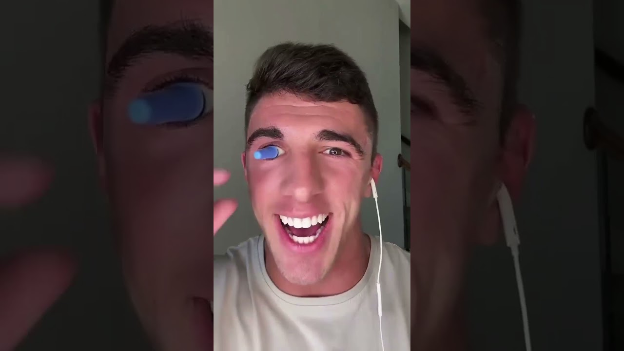 Bro Lost His Eye And Scream A Goofy Ahh Horn 