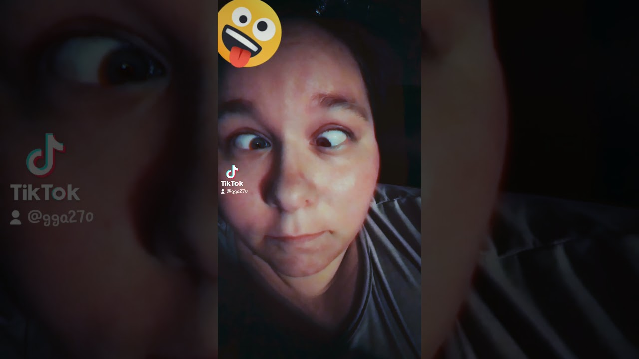 Anyone else got weird eyes?