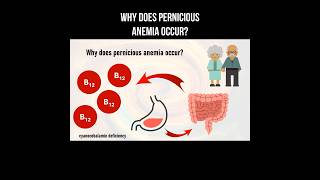 Why does pernicious anemia occur? #perniciousanemia #anemia #blooddisorders #vitaminb12