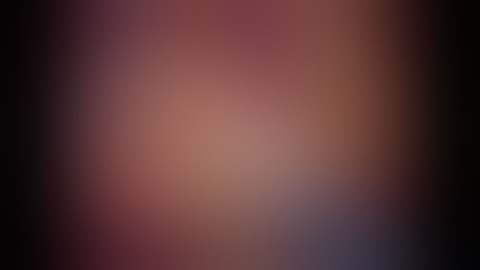 Robotic extended right colectomy with complete mesocolic excision