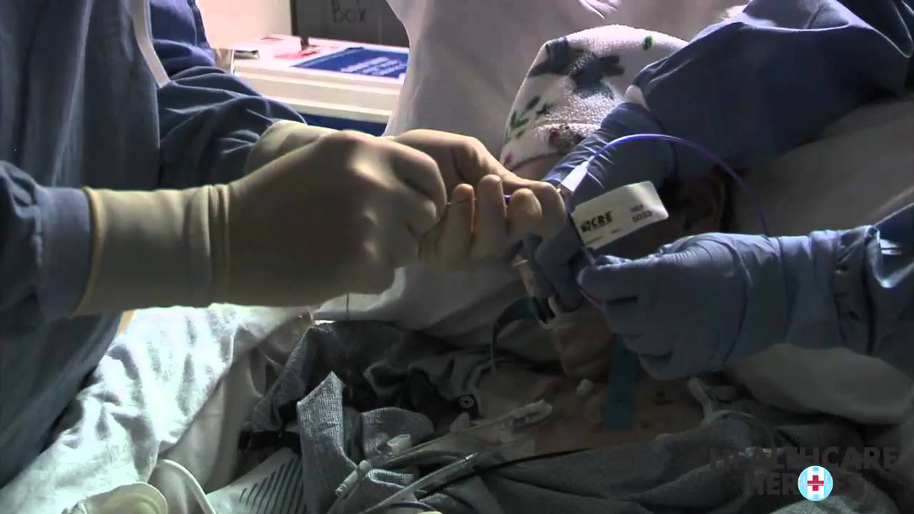 Lung Cancer Procedure YouTube