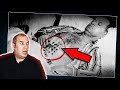 ذهب للمستشفي بعلامات غريبة في بطنه فصدم الأطباء والعالم بقصته Osha Salah قصص 