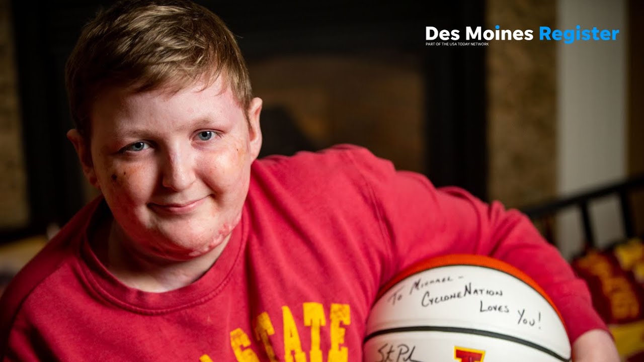 15-year-old battling deadly disorder finds support in Steve Prohm, 