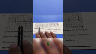 How to identify EKG rhythms pt2 #nursingstudent #monitortech #nursing #cardiacmonitoring
