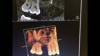 Whoa!  3D dental X-rays  That's incredible!