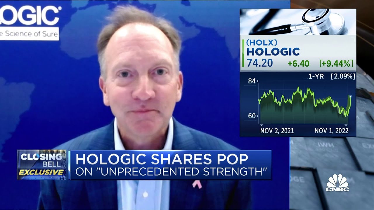 Hologic CEO: Forecasting conservatively while also responding to market needs