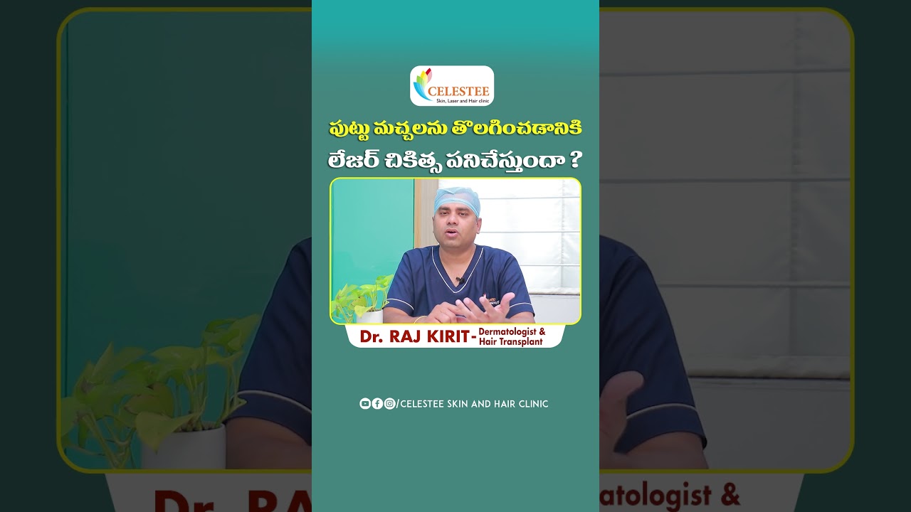 Laser Treatment for Birthmarks Removal || Dr Raj Kirit || Celestee Skin And Hair Clinic 