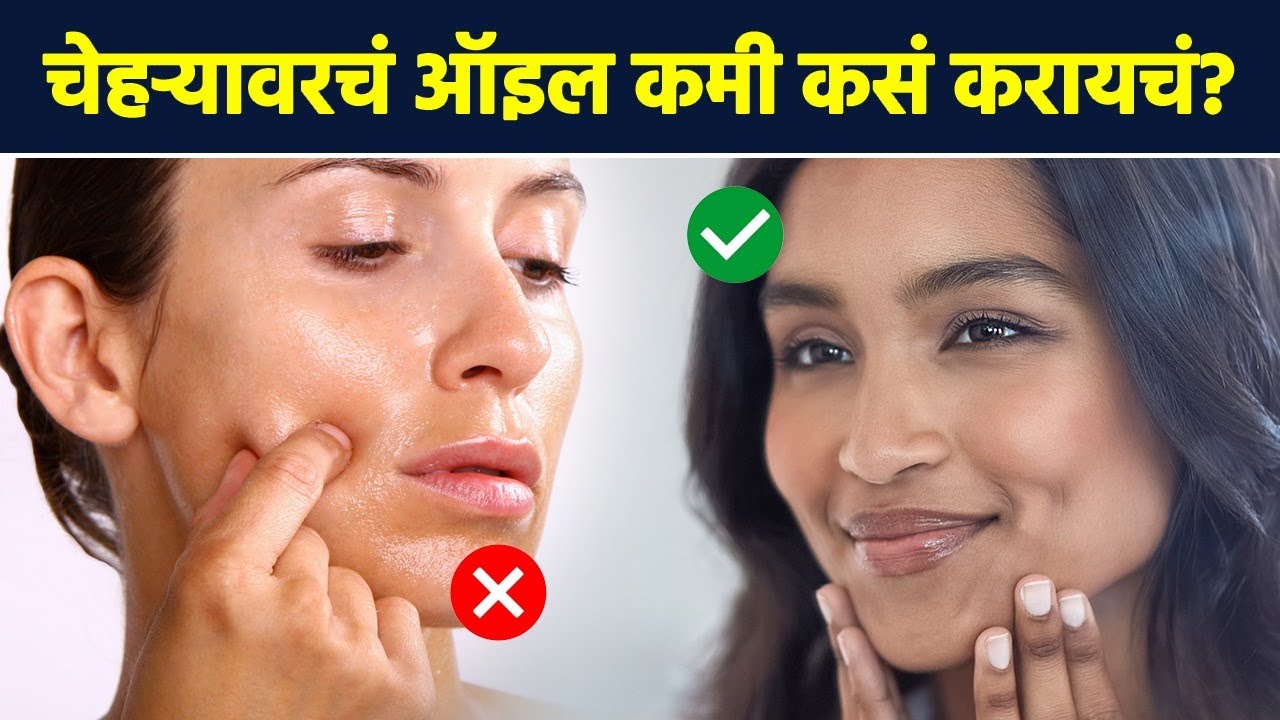 तेलकट चेहऱ्यावर करा घरगुती उपाय How to Get Rid of Oily Face Naturally