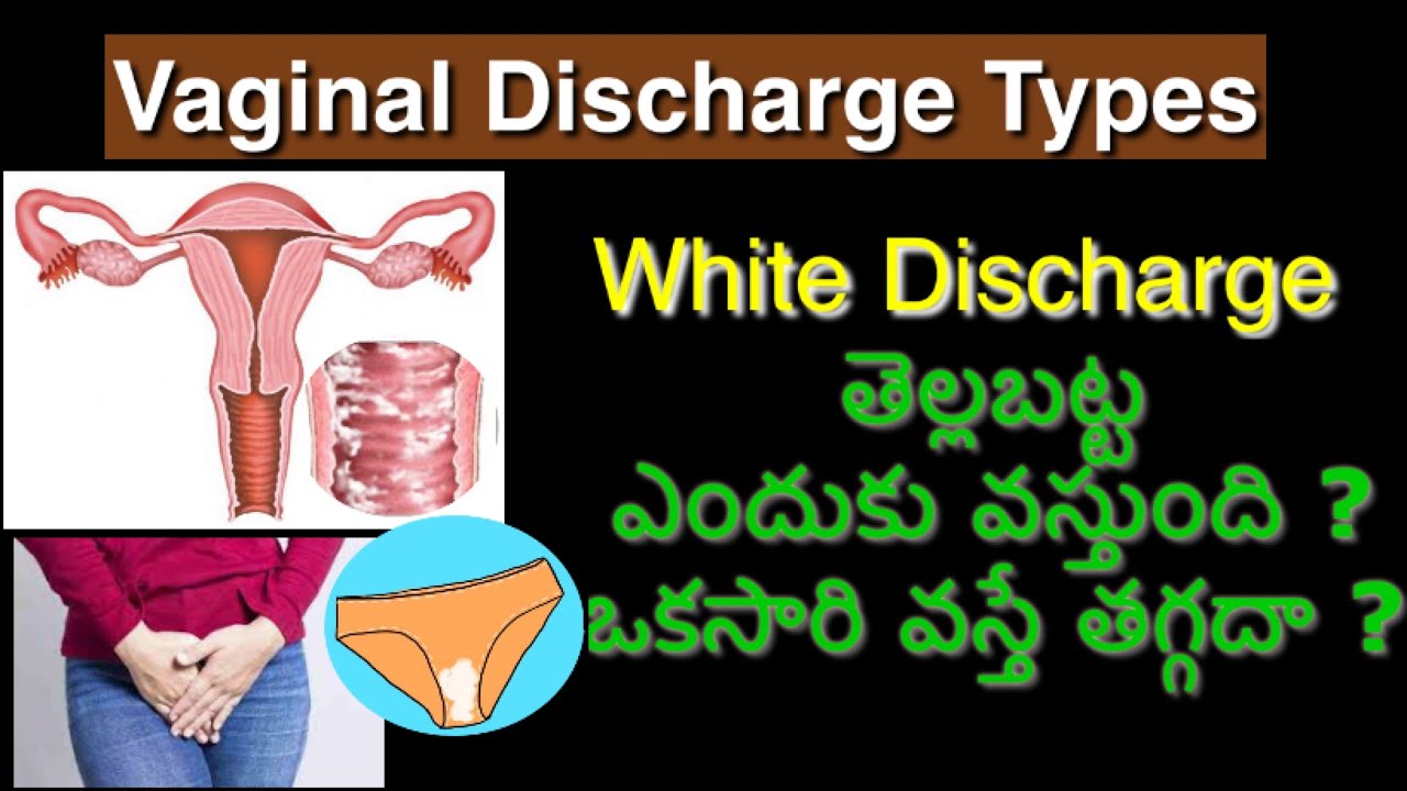 White Discharge Vaginal Discharge Types In Telugu 