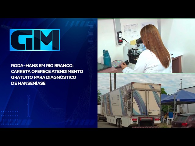 RODA-HANS EM RIO BRANCO: CARRETA OFERECE ATENDIMENTO GRATUITO PARA DIAGNÓSTICO DE HANSENÍASE